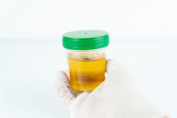 BULĂ trebuie să ducă o probă de urină