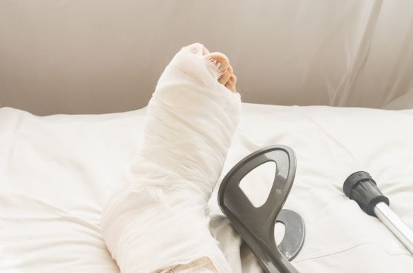 – Doctore, mi-am fracturat piciorul